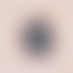Melanom, malignes, superfiziell spreitendes. Tiefschwarzer Tumor mit radial streaming und pseudop...