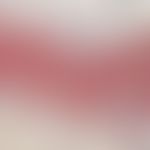 Melanom, malignes, superfiziell spreitendes. Immunhistologie (MART): Diffuse Durchsetzung von Obe...
