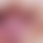 Melanom, malignes, superfiziell spreitendes. Auflichtmikroskopie Detailvergrößerung: Regressives ...