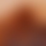 Melanom, malignes, superfiziell spreitendes. Auflichtmikroskopie: Randbereich, Clark Level III, T...