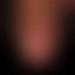 Lentigo of the mucosa. Benign hyperpigmentation that requires semi-annual control.
