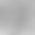 Merkel cell. electron microscopy: Bright Merkel cell (M) characterized by the argyrophilic granul...
