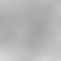 Merkel cell. electron microscopy: Bright Merkel cell (M) characterized by the argyrophilic granul...