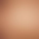 Miliaria pustulosa, multiple seeding of pinhead-sized, reddish papules and yellowish vesicles wit...