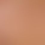 Detail enlargement: Solitarymilieu at the décolleté of a 78-year-old patient with several telangi...