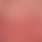 Molluscum contagiosum: Übersichtsaufnahme: Stark juckende Suberythrodermie mit Befall des gesamte...
