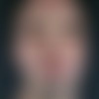 Morbihan, M.:&nbsp;großflächiger, das gesamte Gesicht homogen betreffende, chronisch stationäre, ...