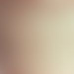 Mucinosis follicularis:&nbsp;follikulär gebundene Papeln mit zentralem Hornkegel; seit 3 Monaten,...