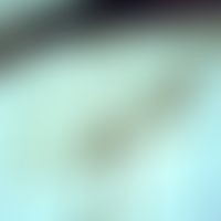 Mosquitoes. anopheles (mosquito ). the wings are long, narrow and with fine veining. the veins ar...