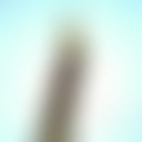Mosquitoes. Anopheles larva. These mosquitoes have no breathing tube, they lie parallel to the wa...