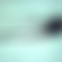 mosquitoes. culex-females (mosquitoes). the males have longer feelers, and these are partly longe...