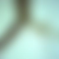 mosquitoes. culex larva. in the area of the siphon (rear part) the breathing tube is visible (dar...