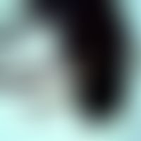 Mosquitoes: Simulium damnosum (blackfly, order Diptera), altogether fly-like habitus, compactly b...