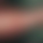 Münchhausen-Syndrom. Artefaktödem am Unterschenkel durch massive Bindenkomprimierung des Fußes bi...
