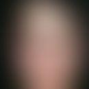 Plaqueförmige Muzinose(n):&nbsp;plaqueförmige, idiopathische, kutane Muzinose. Rote, eher scharf ...