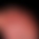 Myiasis externa bei gramnegativem Fußinfekt

