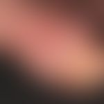 Mycobacterium marinum/Mykobakteriose, nichtuberkulöse:&nbsp;chronische verruköse, unscharf begren...