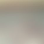 Myxödem prätibiales:&nbsp;Schleimansammlung. Alcianblau-PAS-Färbung.
