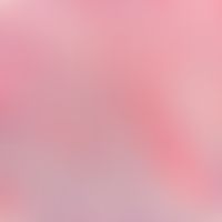 Myxom, kutanes. Detailausschnitt: Das präexistente Bindegewebe (eosinophile Stränge) wird durch e...