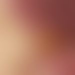 Nabelmetastase. Auflichtmikroskopie (Detailvergrößerung): Multiple polymorphe Gefäßfiguren mit un...