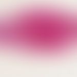 Blue nevus. simple blue nevus; blurredly limited tumor formations which penetrate the entire derm...