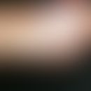 Hamartom, ekkrines. Seit dem 1. Lebensjahr bestehende, druckschmerzhafte Knoten mit lokaler Hyper...