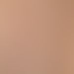 Naevus, epidermaler:&nbsp;seit Geburt bestehende, erhabene, symptomlose, linear angeordnete, in g...