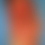Naevus, melanozytärer, Naevus giganteus. Unmittelbar postoperativ. Das abradierte Areal ist pigme...