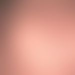 Naevus sebaceus: klinischer Aspekt&nbsp;eines Naevus sebaceus bei einem wenige Monate alten Säugl...