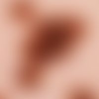 Naevus spilus. Auflichtmikroskopie: Retikuläres Pigmentmuster im Randbereich eines Naevus spilus.