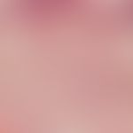 Naevus Spitz: Detail enlargement: Hyperplastic epidermis, pronounced ortho-hyperkeratosis. intrae...
