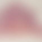 Gewönlicher melanozytärer Naevus, Verruköser melanozytärer Naevus vom dermalen Typ. Zur Basis ist...