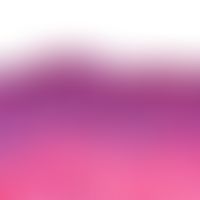 nevus, melanocytic. junctional type. elongation of the reteleases. increased basal pimentation. n...
