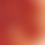 Naevus, melanozytärer. Auflichtmikroskopie: Compoundnaevus (Ausschnitt) im Brustbereich einer 32-...