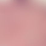 Nasal papule, fibrous. Homogenized, perifollicularly compressed connective tissue. Bulky cell inf...