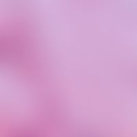 Neurofibrom. Detailaufnahme des Tumorstromas bei diffusem Neurofibrom. Aufgelockertes Stroma mit ...