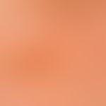 Notalgia paraesthetica. detail enlargement: Approx. 5 x 4 cm measuring, burning, itchy, brownish ...