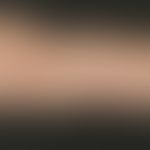 Oleom. Übersichtsaufnahme: Eher untypisches Bild einer schmerzhaften und livide verfärbten, geweb...