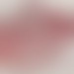 Onchozerkose. Multiple Querschnitte durch einen adulten Wurm im Korium.