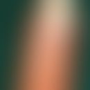 Onycholysis semilunaris. arch-shaped, traumatogenically induced detachment of the nail. suction o...