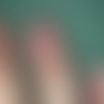 Onychophagie:&nbsp;Fehlen der distalen Nagelplatte am Zeigefinger durch Abbeißen bei einer 33-jäh...