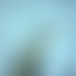 Oxyuriasis. tail of a female Enterobius vermicularis. typical is the extremely pointed rear end (...