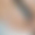 Pachyonychia congenita: alle Finger- und Zehennägel betreffende, angeborene Nageldystrophie mit P...