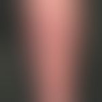 Papillomatosis cutis lymphostatica. Übersichtsaufnahme: Nach distal scharf, nach proximal unschar...