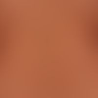 Pityriasis lichenoides chronica
