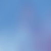 Pautriersche Mikroabszesse. Kutanes T-Zell-Lymphom, "Abszessartige" Verdichtung epitheliotroper L...