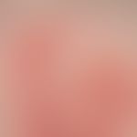 Pemphigoid, bullöses:&nbsp;Detailauschnitt: 1-6 mm große, prall gespannte, mit klarem Sekret gefü...