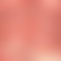Pemphigoid, bullous. general view: multiple, disseminated, 0.3-2.0 cm large, taut, mostly filled ...