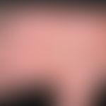 Pemphigoid, bullöses. Seit 1 Jahr bestehende, mit gelblicher Flüssigkeit gefüllte, pralle, jucken...