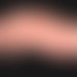 Pemphigoid&nbsp;bullöses: multiple&nbsp;pralle&nbsp;Blasen mit gelblichem und hämorrhagischem Bla...